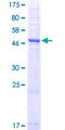 AQP1 / Aquaporin 1 Protein - 12.5% SDS-PAGE of human AQP1 stained with Coomassie Blue