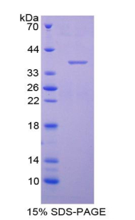 AQP1 / Aquaporin 1 Protein - Recombinant Aquaporin 1, Colton Blood Group By SDS-PAGE