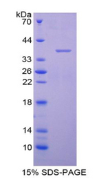 AQP1 / Aquaporin 1 Protein - Recombinant Aquaporin 1, Colton Blood Group By SDS-PAGE