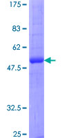 AQP2 / Aquaporin 2 Protein - 12.5% SDS-PAGE of human AQP2 stained with Coomassie Blue