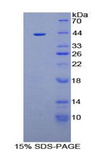 AQP2 / Aquaporin 2 Protein - Recombinant Aquaporin 2, Collecting Duct By SDS-PAGE