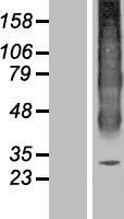 AQP6 / Aquaporin 6 Protein - Western validation with an anti-DDK antibody * L: Control HEK293 lysate R: Over-expression lysate