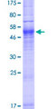 AQP7 / Aquaporin 7 Protein - 12.5% SDS-PAGE of human AQP7 stained with Coomassie Blue