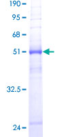 AQP8 / Aquaporin 8 Protein - 12.5% SDS-PAGE of human AQP8 stained with Coomassie Blue