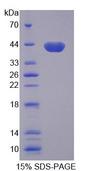 AQP8 / Aquaporin 8 Protein - Recombinant Aquaporin 8 (AQP8) by SDS-PAGE