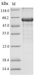 AR / Androgen Receptor Protein - (Tris-Glycine gel) Discontinuous SDS-PAGE (reduced) with 5% enrichment gel and 15% separation gel.