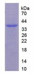AR / Androgen Receptor Protein - Recombinant Androgen Receptor By SDS-PAGE