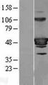 ARA55 / HIC-5 Protein - Western validation with an anti-DDK antibody * L: Control HEK293 lysate R: Over-expression lysate