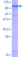 ARA70 / NCOA4 Protein - 12.5% SDS-PAGE of human NCOA4 stained with Coomassie Blue