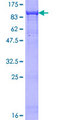 ARA70 / NCOA4 Protein - 12.5% SDS-PAGE of human NCOA4 stained with Coomassie Blue