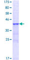 ARA70 / NCOA4 Protein - 12.5% SDS-PAGE Stained with Coomassie Blue.