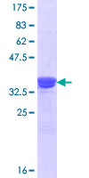 ARA9 / AIP Protein - 12.5% SDS-PAGE Stained with Coomassie Blue.