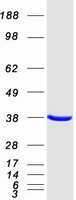 ARA9 / AIP Protein - Purified recombinant protein AIP was analyzed by SDS-PAGE gel and Coomassie Blue Staining