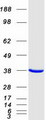 ARA9 / AIP Protein - Purified recombinant protein AIP was analyzed by SDS-PAGE gel and Coomassie Blue Staining