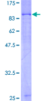 ARAF / ARAF1 / A-RAF Protein - 12.5% SDS-PAGE of human ARAF stained with Coomassie Blue