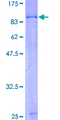ARAF / ARAF1 / A-RAF Protein - 12.5% SDS-PAGE of human ARAF stained with Coomassie Blue