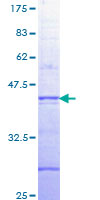 ARAF / ARAF1 / A-RAF Protein - 12.5% SDS-PAGE Stained with Coomassie Blue.