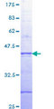 ARAF / ARAF1 / A-RAF Protein - 12.5% SDS-PAGE Stained with Coomassie Blue.