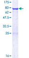 ARC / Arg3.1 Protein - 12.5% SDS-PAGE of human ARC stained with Coomassie Blue