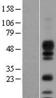 AREG / Amphiregulin Protein - Western validation with an anti-DDK antibody * L: Control HEK293 lysate R: Over-expression lysate