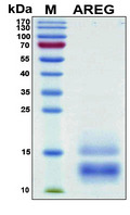 AREG / Amphiregulin Protein - SDS-PAGE under reducing conditions and visualized by Coomassie blue staining