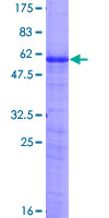 AREG / Amphiregulin Protein - 12.5% SDS-PAGE of human AREG stained with Coomassie Blue