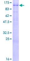 AREL1 / KIAA0317 Protein - 12.5% SDS-PAGE of human KIAA0317 stained with Coomassie Blue
