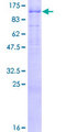 AREL1 / KIAA0317 Protein - 12.5% SDS-PAGE of human KIAA0317 stained with Coomassie Blue