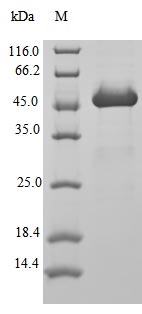 ARF1 Protein - (Tris-Glycine gel) Discontinuous SDS-PAGE (reduced) with 5% enrichment gel and 15% separation gel.