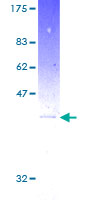 ARF1 Protein - 12.5% SDS-PAGE of human ARF1 stained with Coomassie Blue