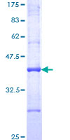 ARF1 Protein - 12.5% SDS-PAGE Stained with Coomassie Blue.