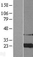 ARF4 Protein - Western validation with an anti-DDK antibody * L: Control HEK293 lysate R: Over-expression lysate