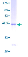 ARF4 Protein - 12.5% SDS-PAGE of human ARF4 stained with Coomassie Blue