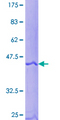 ARF5 Protein - 12.5% SDS-PAGE of human ARF5 stained with Coomassie Blue
