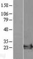 ARF6 Protein - Western validation with an anti-DDK antibody * L: Control HEK293 lysate R: Over-expression lysate