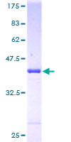 ARF6 Protein - 12.5% SDS-PAGE of human ARF6 stained with Coomassie Blue