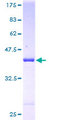 ARF6 Protein - 12.5% SDS-PAGE of human ARF6 stained with Coomassie Blue