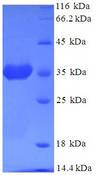 ARF6 Protein