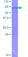 ARFGAP1 Protein - 12.5% SDS-PAGE of human ARFGAP1 stained with Coomassie Blue
