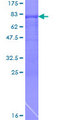 ARFGAP1 Protein - 12.5% SDS-PAGE of human ARFGAP1 stained with Coomassie Blue