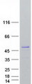 ARFGAP1 Protein - Purified recombinant protein ARFGAP1 was analyzed by SDS-PAGE gel and Coomassie Blue Staining