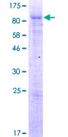 ARFGAP2 / ZNF289 Protein - 12.5% SDS-PAGE of human ZNF289 stained with Coomassie Blue