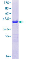 ARFGEF1 Protein - 12.5% SDS-PAGE Stained with Coomassie Blue.