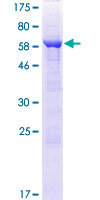 ARFIP1 Protein - 12.5% SDS-PAGE of human ARFIP1 stained with Coomassie Blue