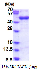 ARFIP1 Protein