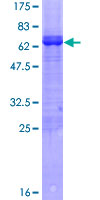 ARFIP2 / Arfaptin 2 Protein - 12.5% SDS-PAGE of human ARFIP2 stained with Coomassie Blue