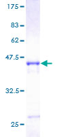 ARFL3 / ARL3 Protein - 12.5% SDS-PAGE of human ARL3 stained with Coomassie Blue