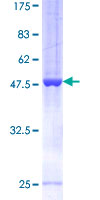 ARFRP1 Protein - 12.5% SDS-PAGE of human ARFRP1 stained with Coomassie Blue