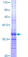 ARFRP1 Protein - 12.5% SDS-PAGE Stained with Coomassie Blue.
