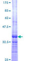 ARFRP1 Protein - 12.5% SDS-PAGE Stained with Coomassie Blue.